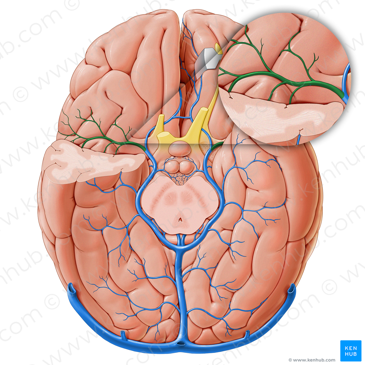 Deep middle cerebral vein (#18251)
