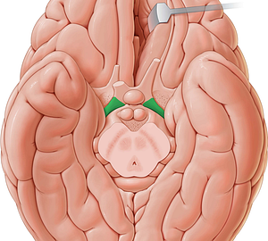 Optic tract (#9528)