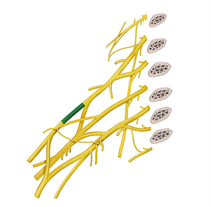 Anterior division of superior trunk of brachial plexus (#20601)