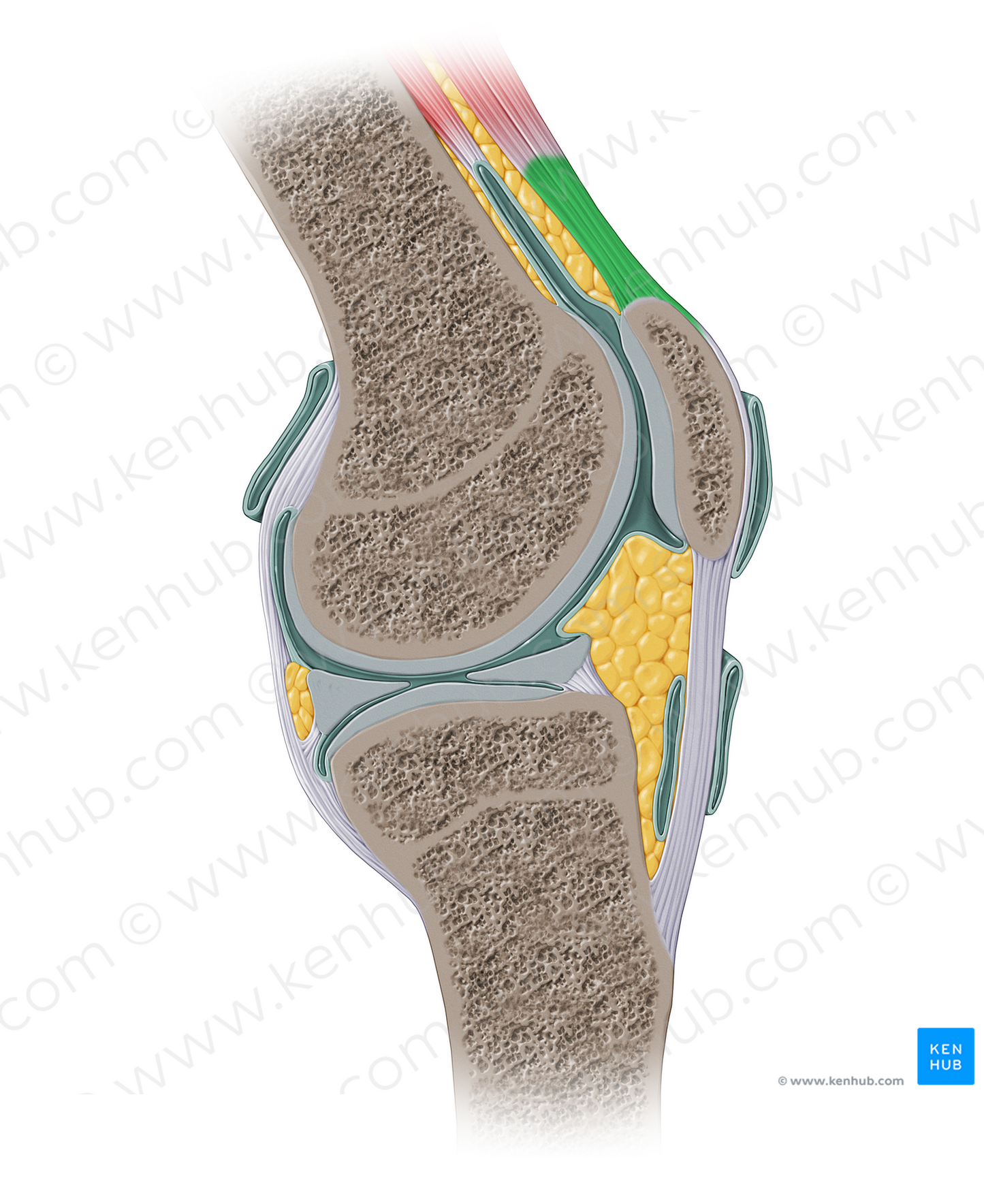 Tendon of quadriceps femoris muscle (#13903)