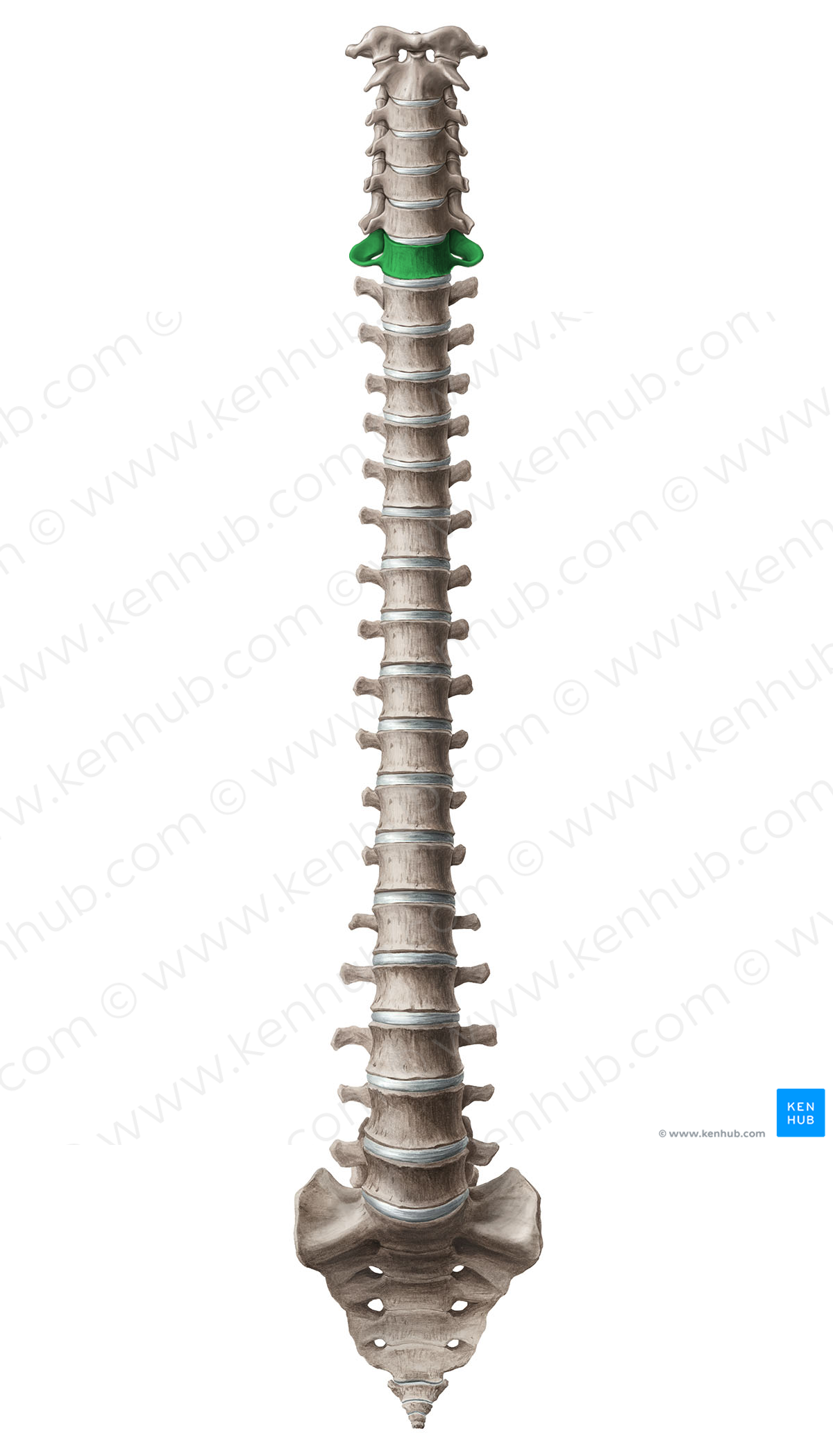 Vertebra C7 (#12568)