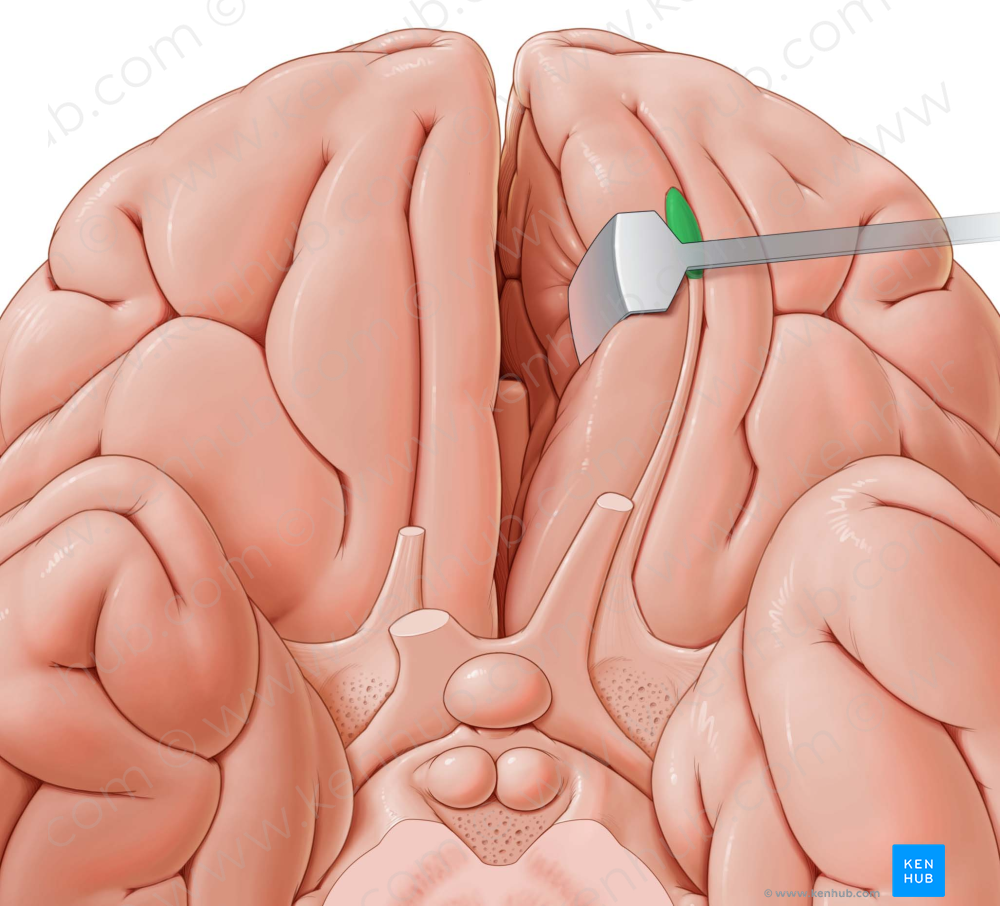 Olfactory bulb (#2250)