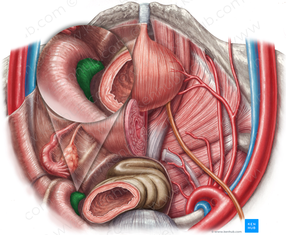 Left internal iliac vein (#10325)