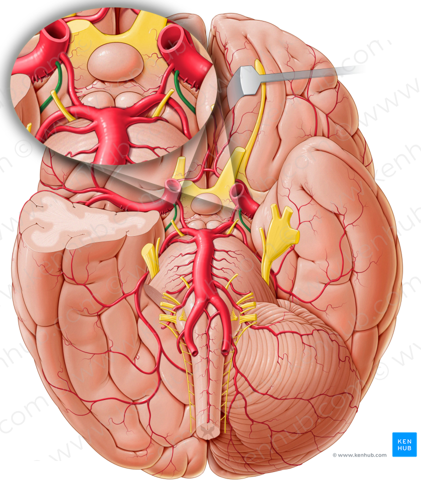 Anterior choroidal artery (#1027)
