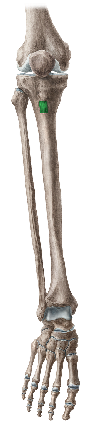 Tibial tuberosity (#9792)