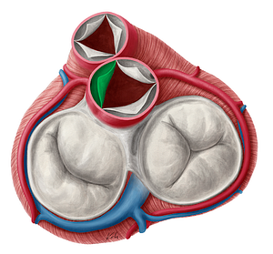 Left coronary leaflet of aortic valve (#9925)