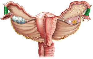 Infundibulum of uterine tube (#4311)