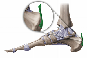 Calcaneal tendon (#11228)