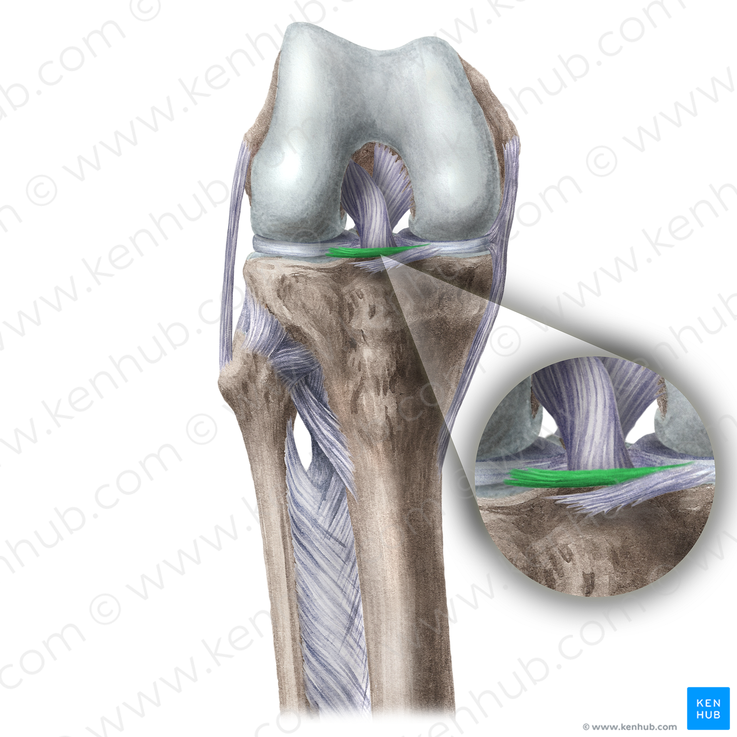 Transverse ligament of knee (#4659)