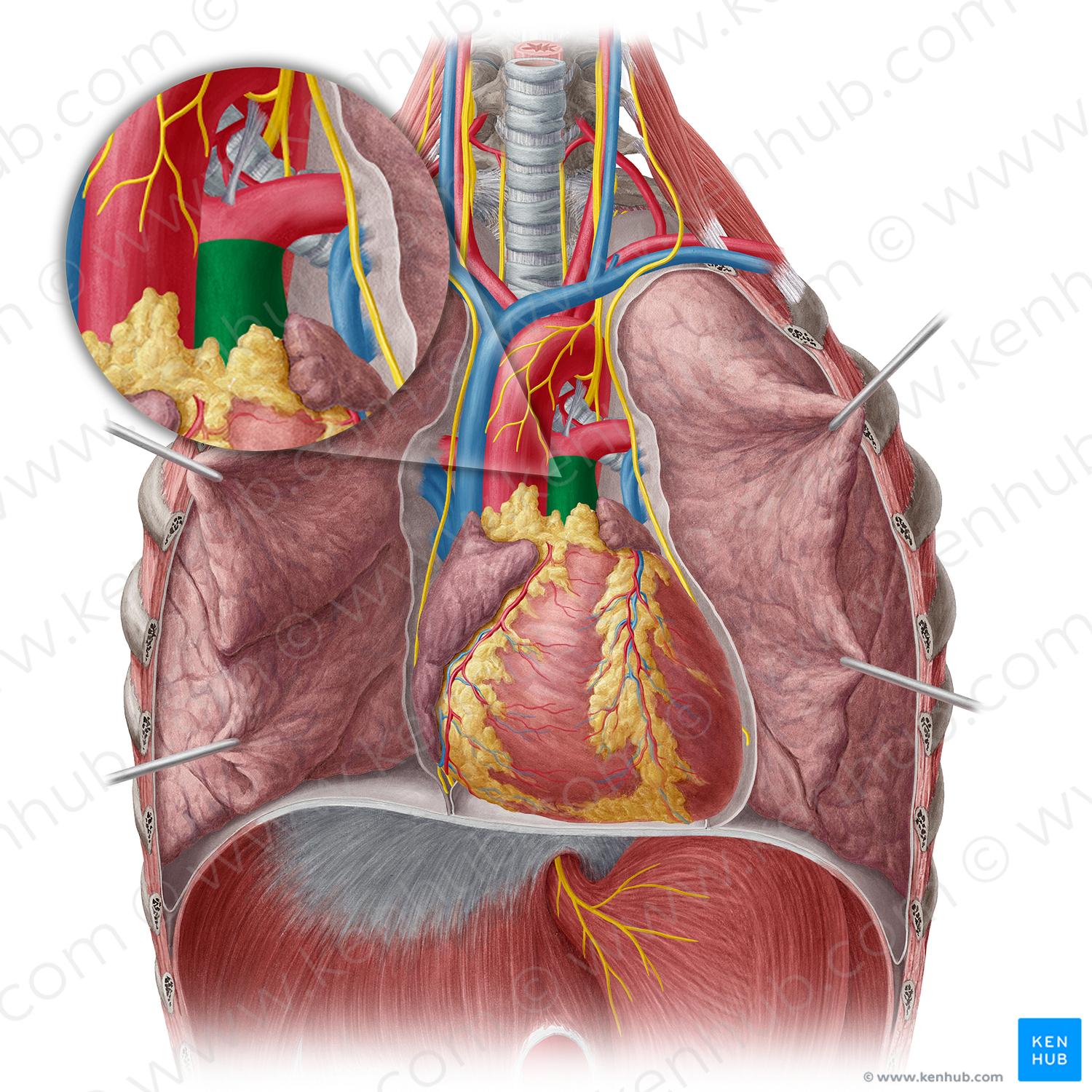 Pulmonary trunk (#9634)