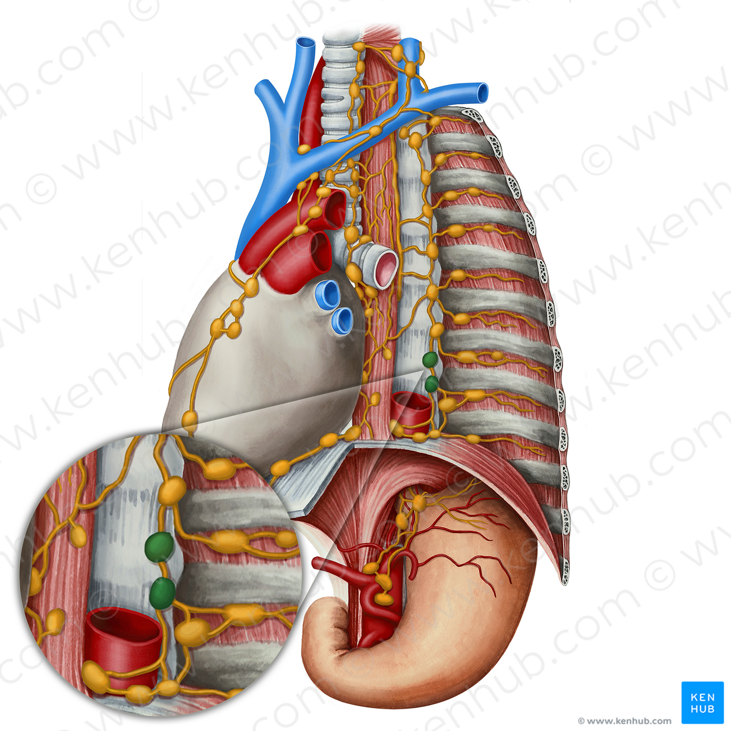 Juxtaaortic lymph nodes (#21821)