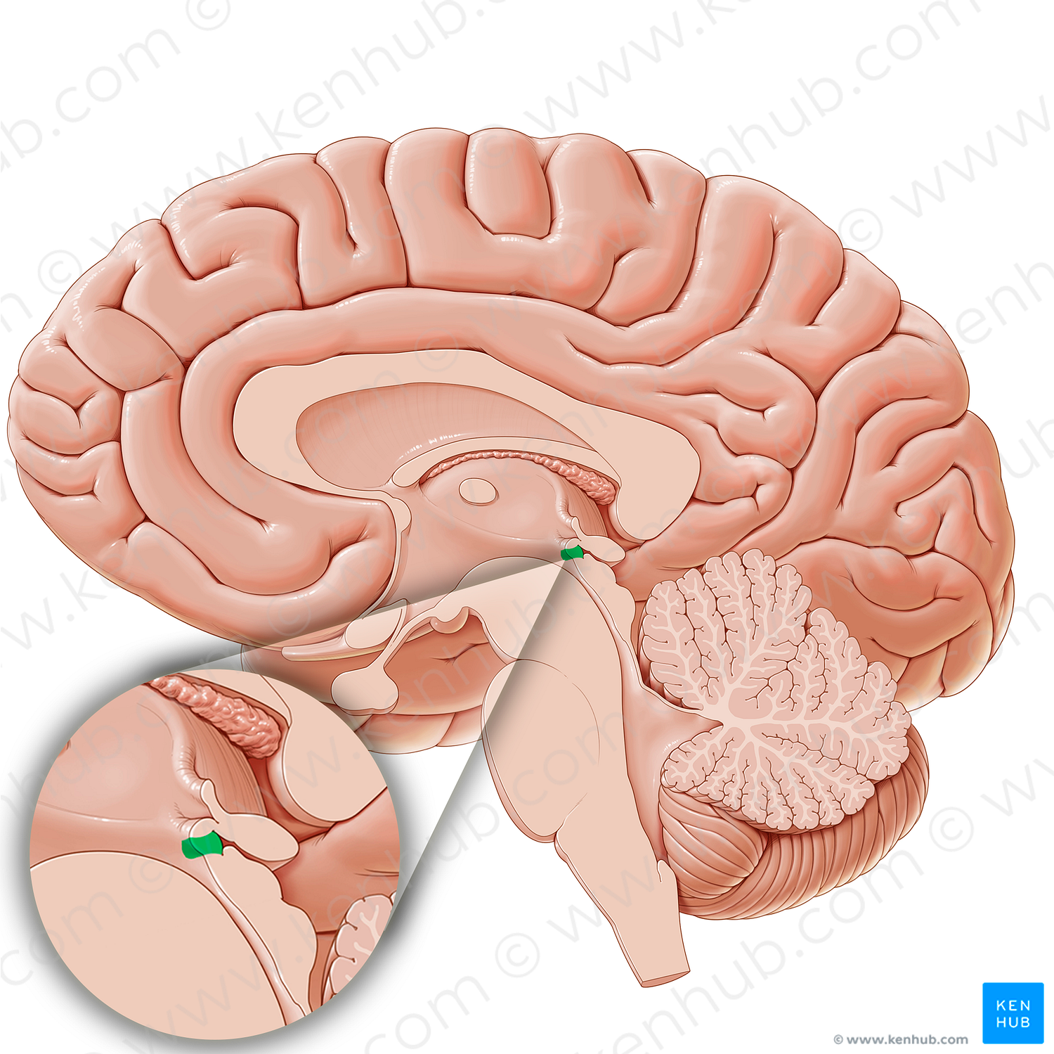 Subcommissural organ (#15820)