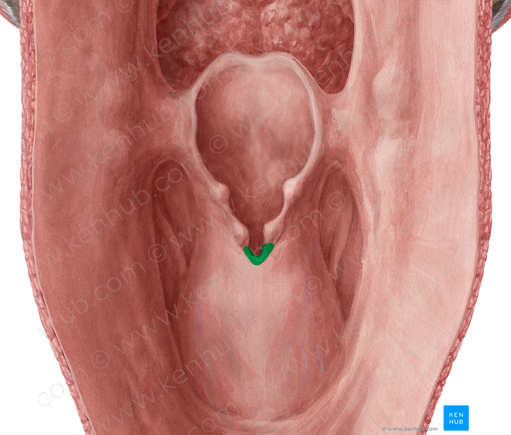 Interarytenoid notch (#4290)