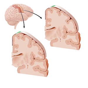 Sensory and motor cortex of trunk (#21230)