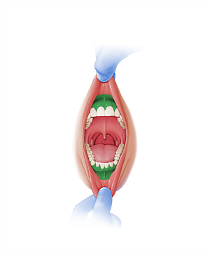 Oral vestibule (#10825)