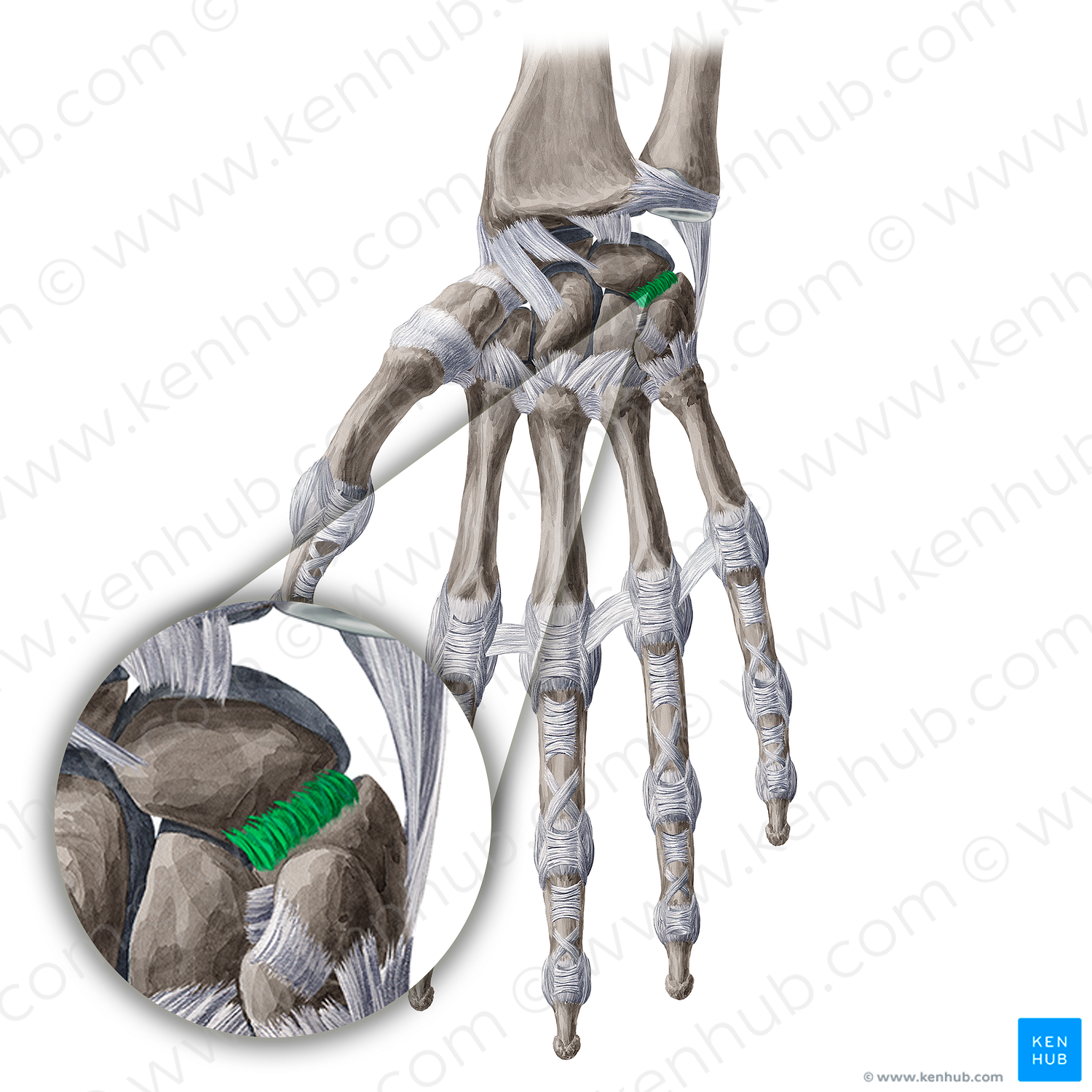 Palmar lunotriquetral ligament (#20615)