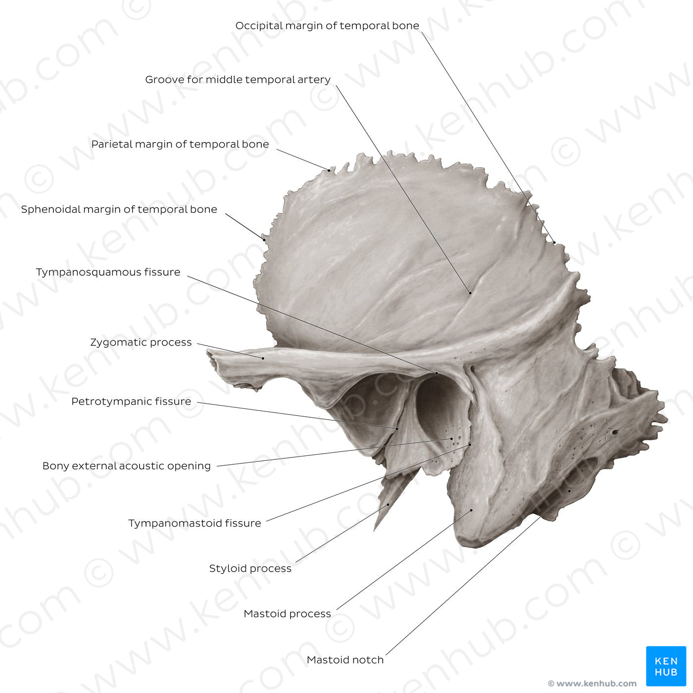 Temporal bone (lateral view) (English)