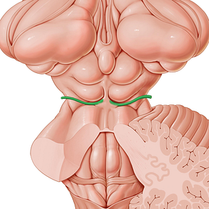 Trochlear nerve (#6846)