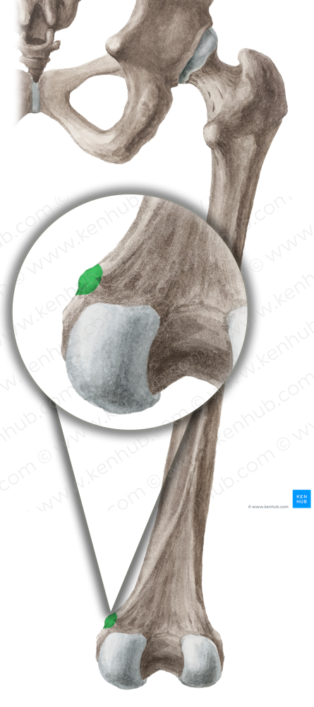 Adductor tubercle of femur (#9704)