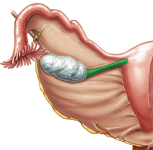 Proper ovarian ligament (#4586)