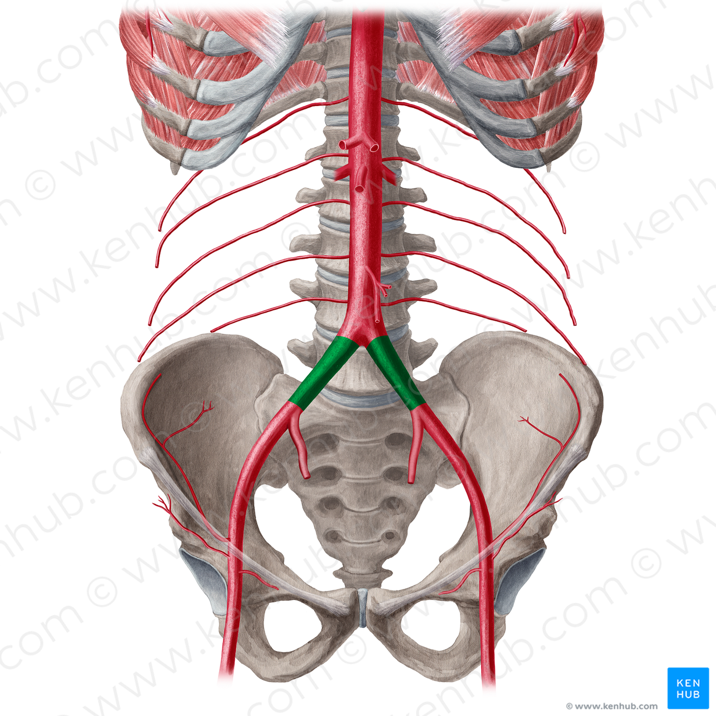 Common iliac artery (#21557)