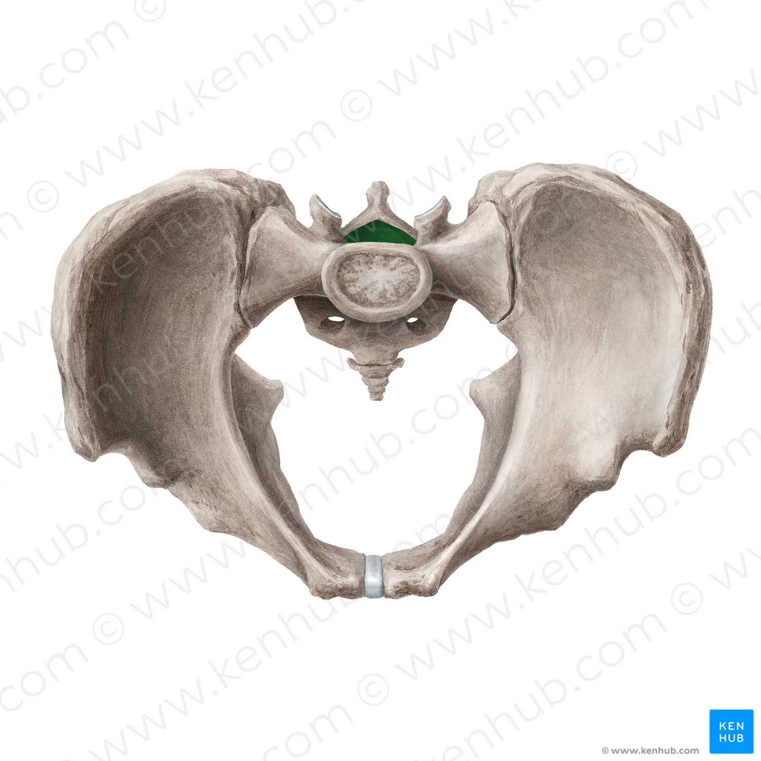 Sacral canal (#21691)