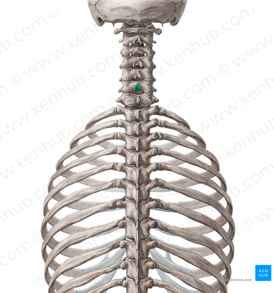 Spinous process of vertebra C6 (#8293)