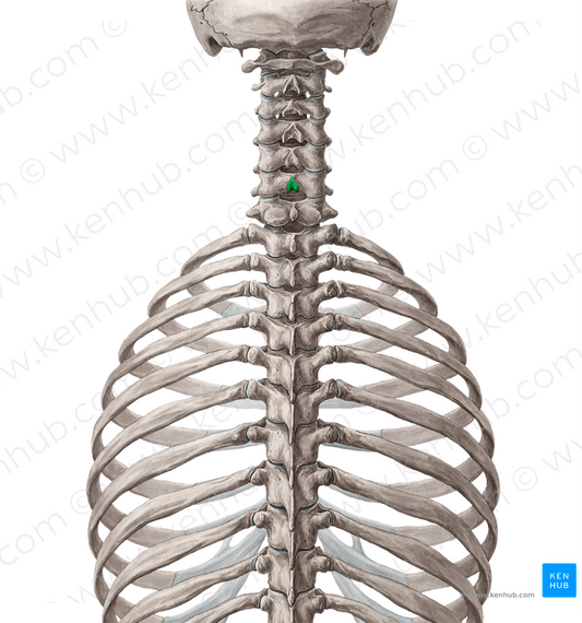 Spinous process of vertebra C6 (#8293)