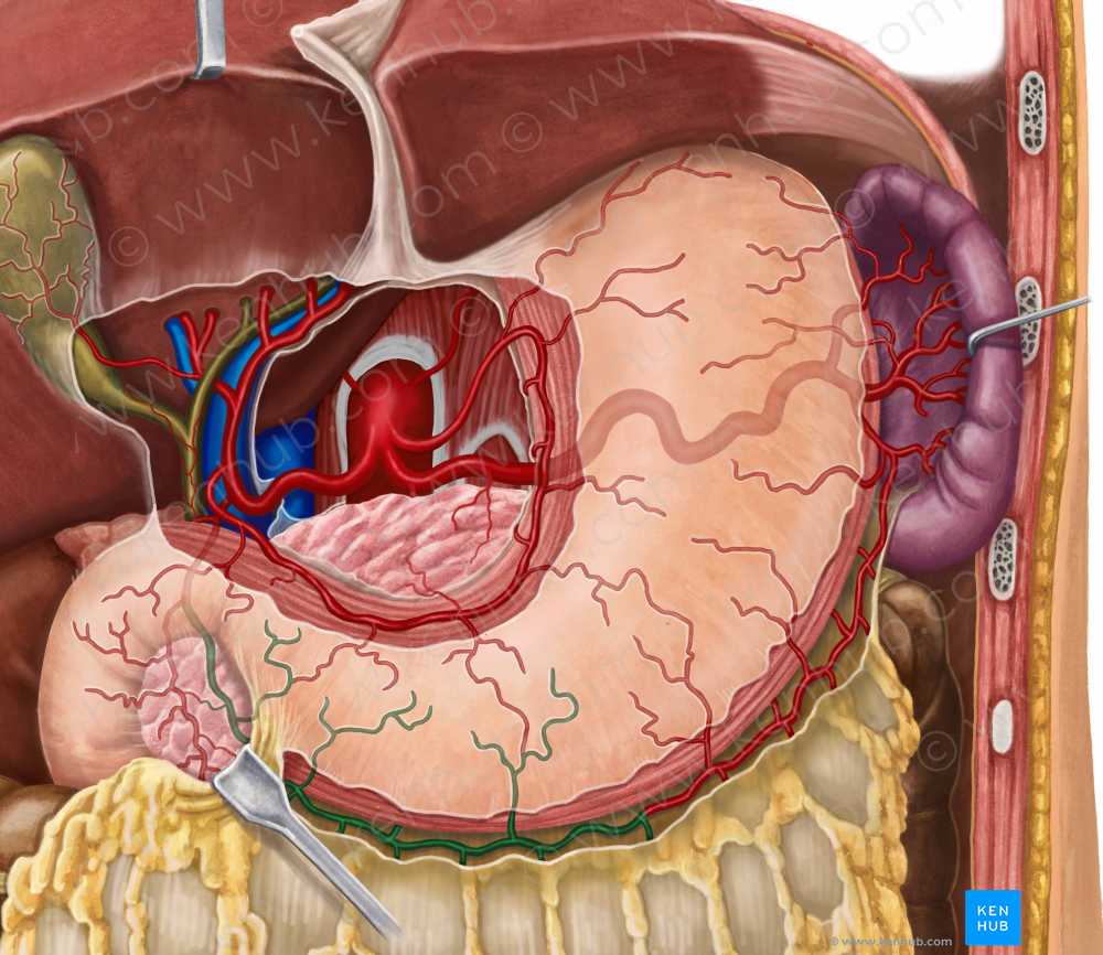 Right gastroomental artery (#1306)