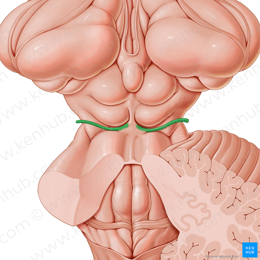 Trochlear nerve (#6846)