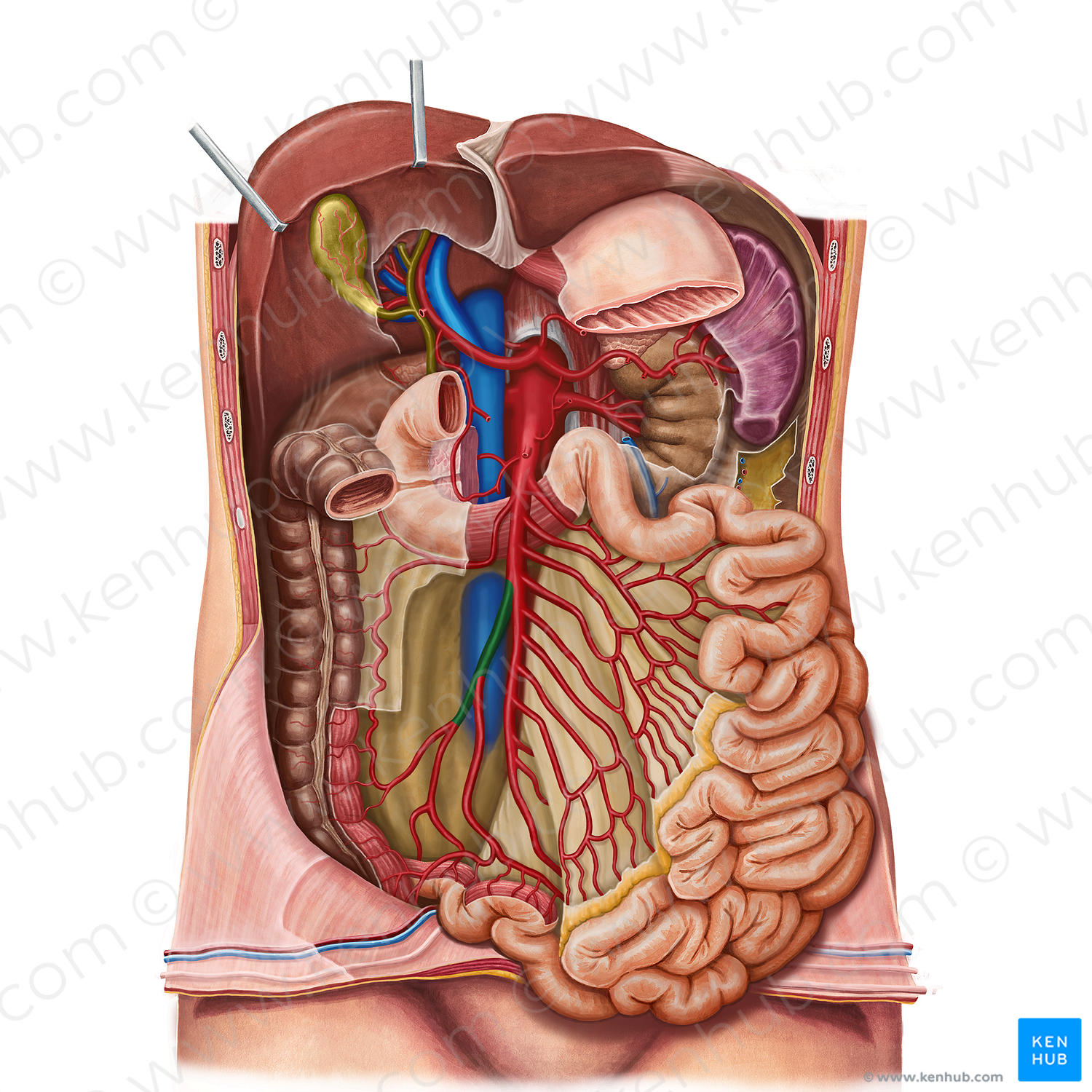 Ileocolic artery (#1362)