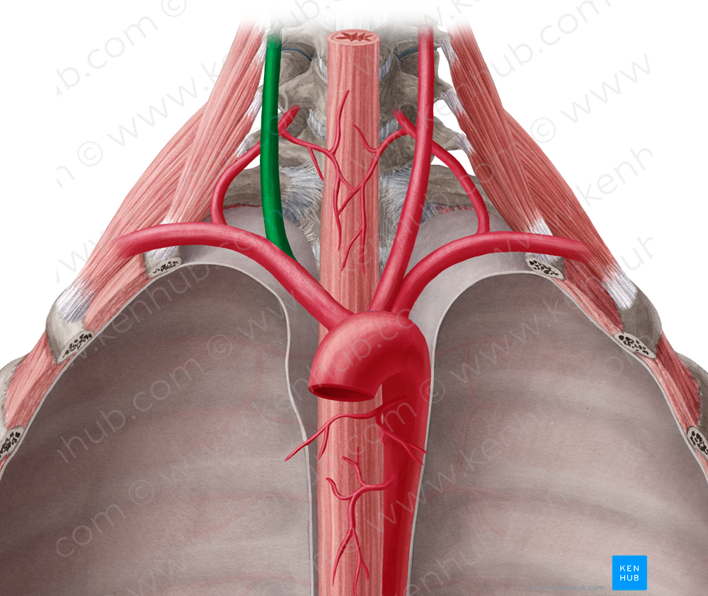 Right common carotid artery (#936)
