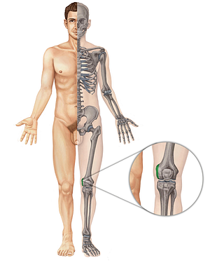 Medial epicondyle of femur (#3401)