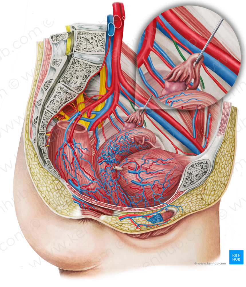 Left superior vesical artery (#1990)