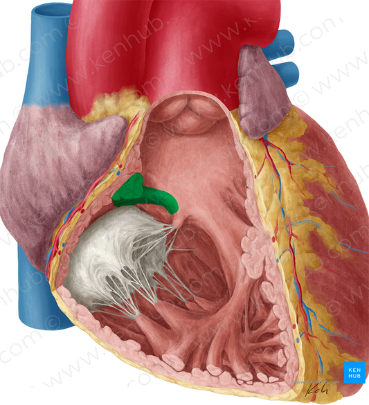 Supraventricular crest (#3137)