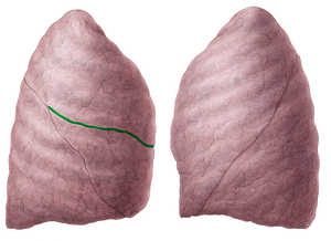 Horizontal fissure of right lung (#3658)