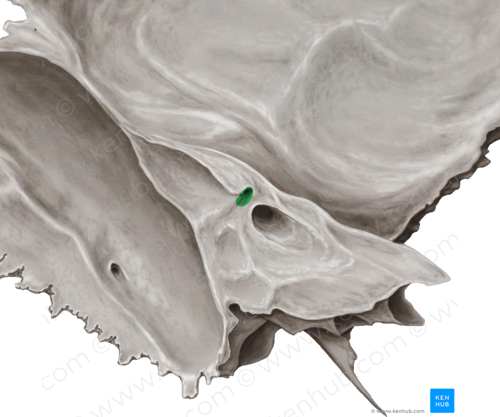 Subarcuate fossa of temporal bone (#3885)