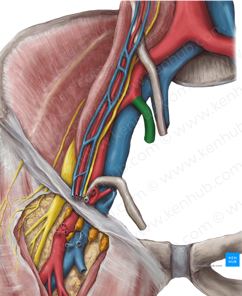 Internal iliac artery (#1422)