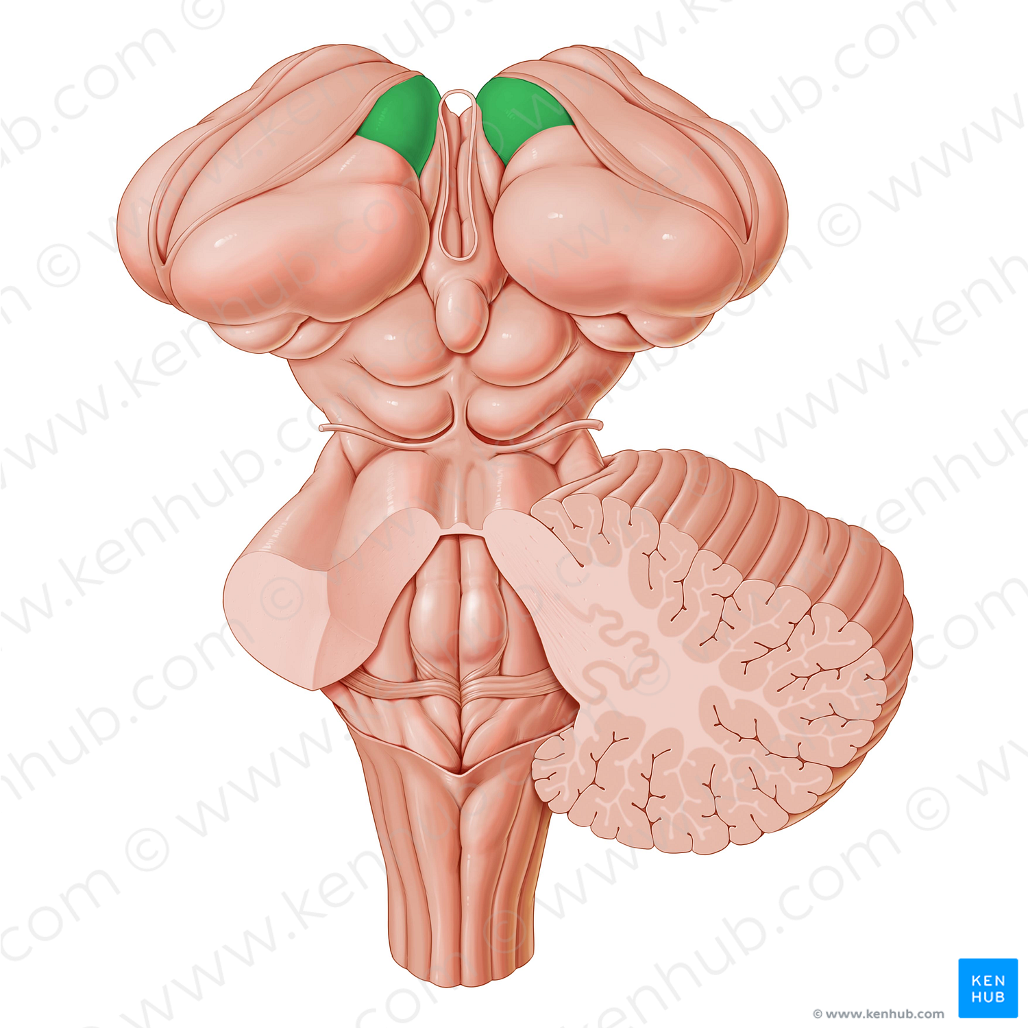 Anterior thalamic tubercle (#9711)