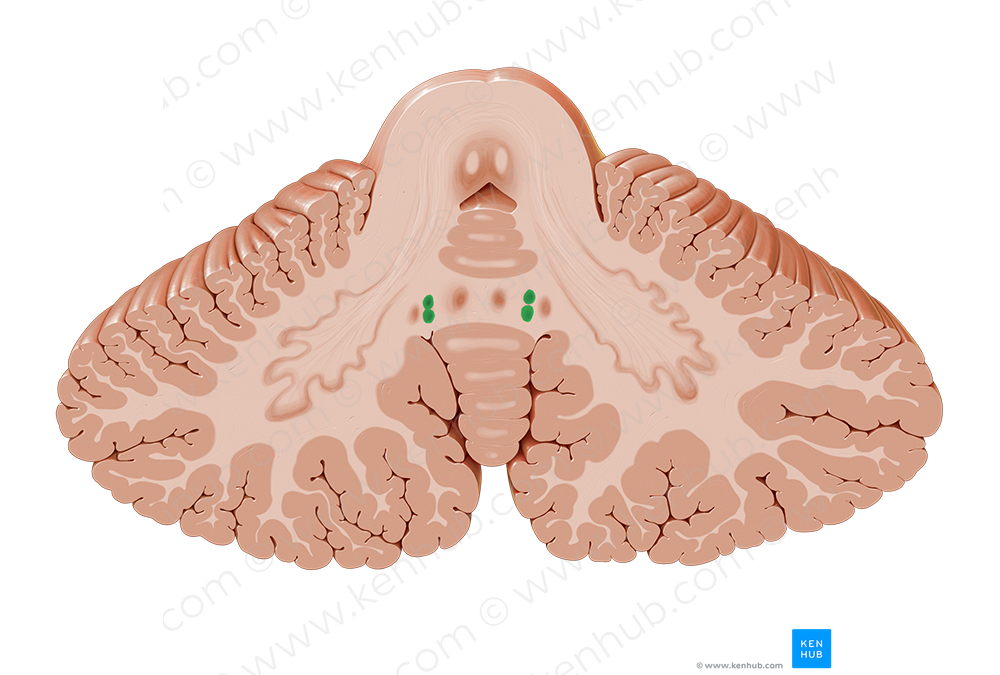 Globose nucleus (#7206)