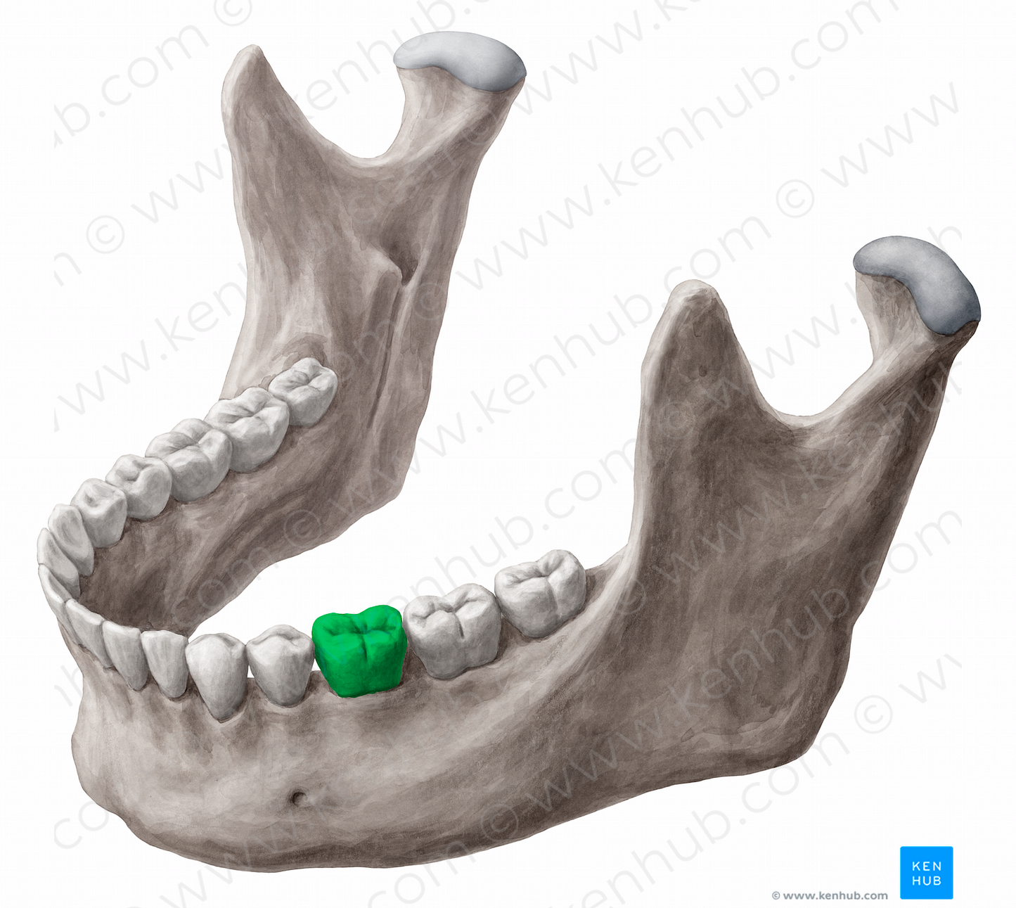 Mandibular left first molar tooth (#12844)