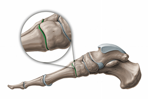 Tarsometatarsal joints (#11254)