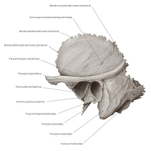 Temporal bone (lateral view) (Spanish)