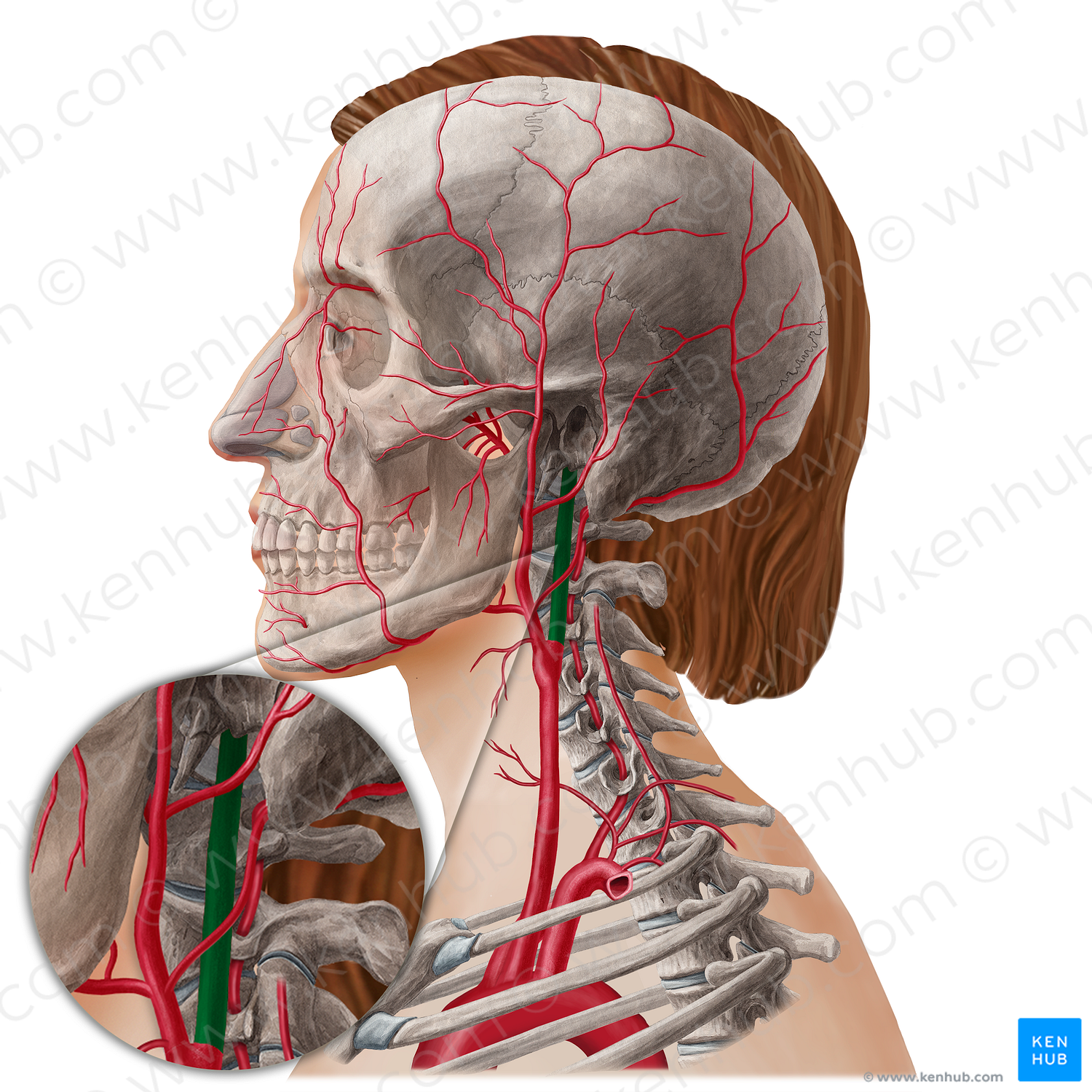 Internal carotid artery (#21792)