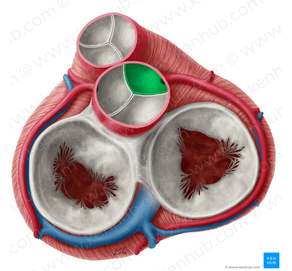 Right coronary leaflet of aortic valve (#9919)