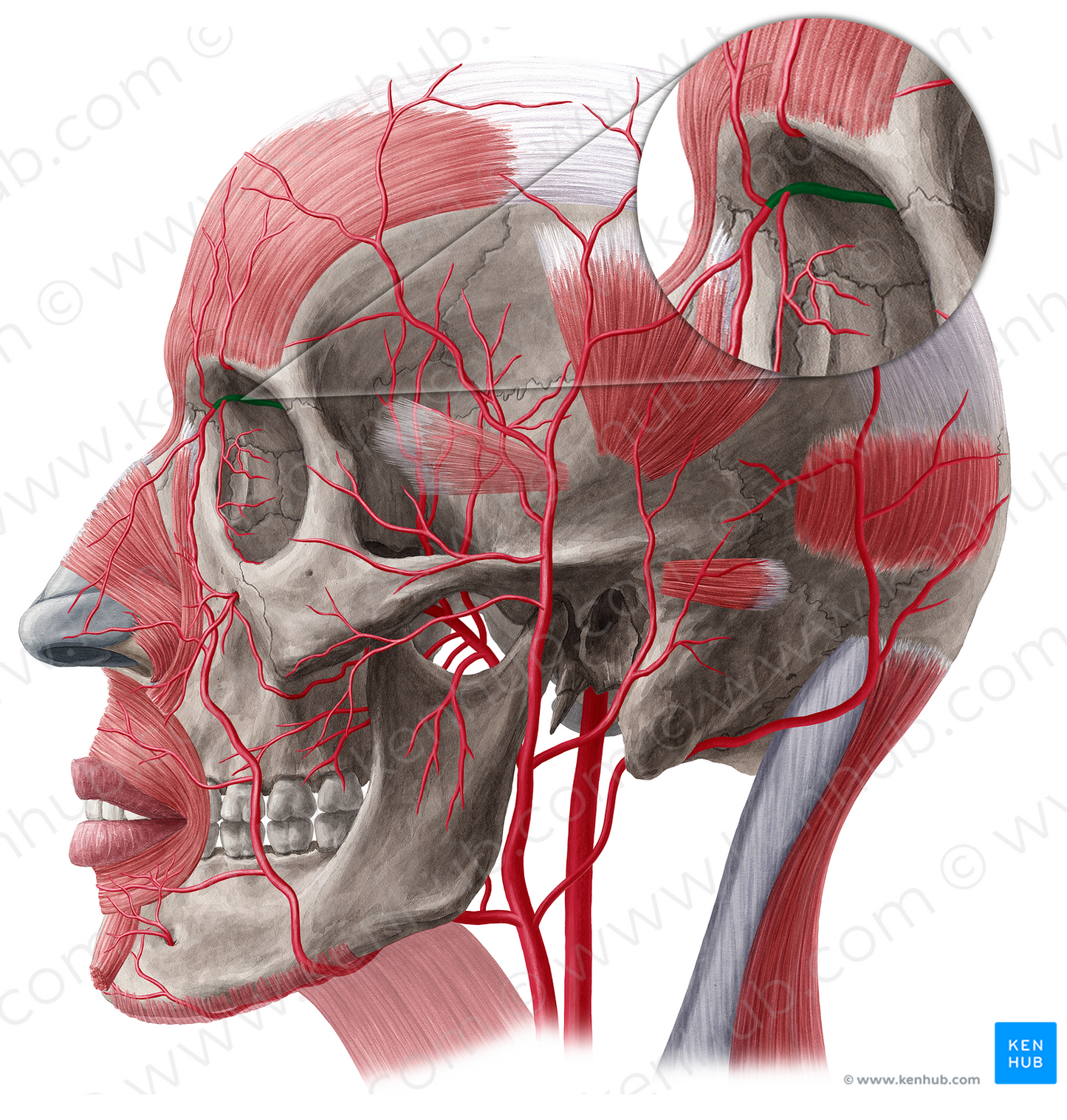 Ophthalmic artery (#20515)