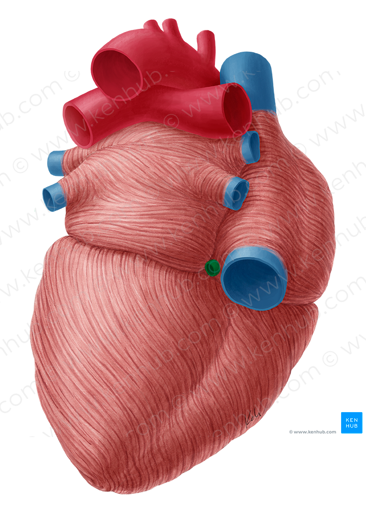 Coronary sinus (#9005)