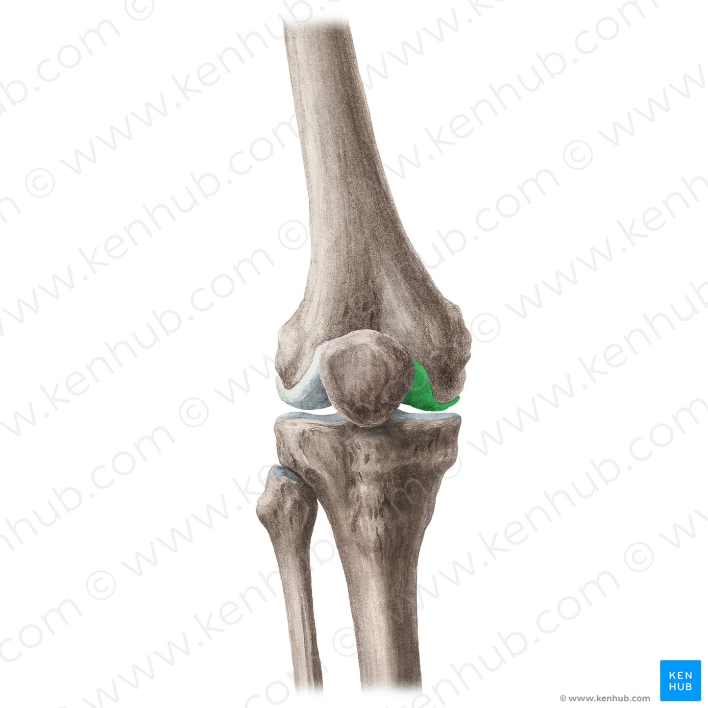 Medial condyle of femur (#20115)