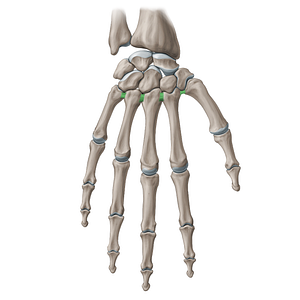 Interosseous metacarpal ligaments (#20983)
