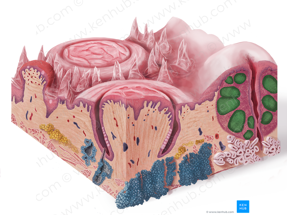 Lymphoid nodule (#7131)